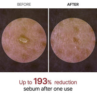 Peel Shot Glow White Rice Peeling Ampoule
